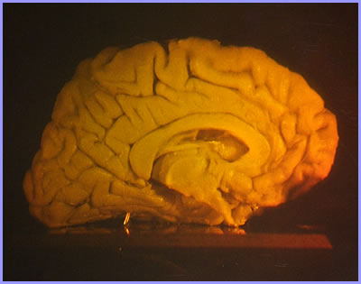 8 x 10 white light hologram of human brain image